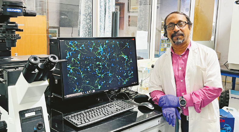 This cholesterol is good for the brain