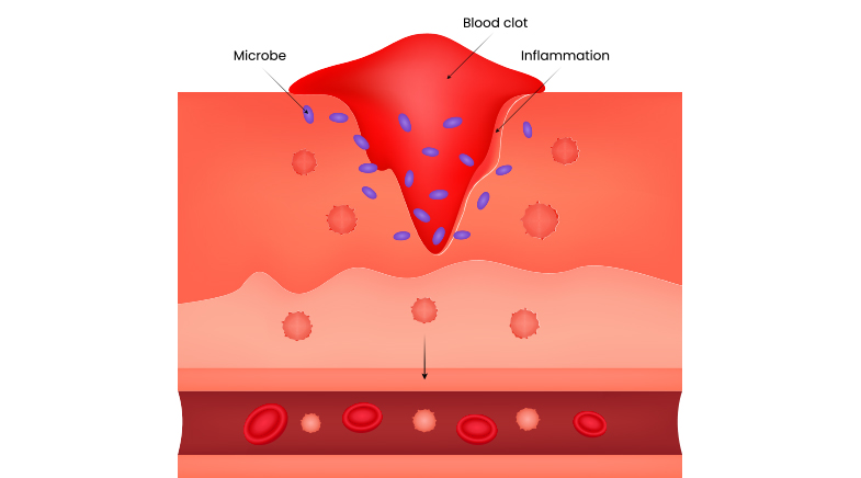 Patching skin with bioink Patching skin with bioink