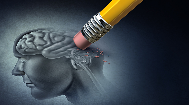 A vision sensor learns to forget -- like the brain