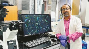 This cholesterol is good for the brain