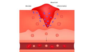 Patching skin with bioink Patching skin with bioink